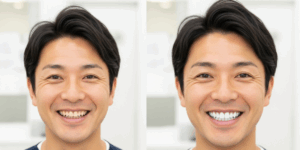 ホワイトニングをすると印象は変わりますか？
